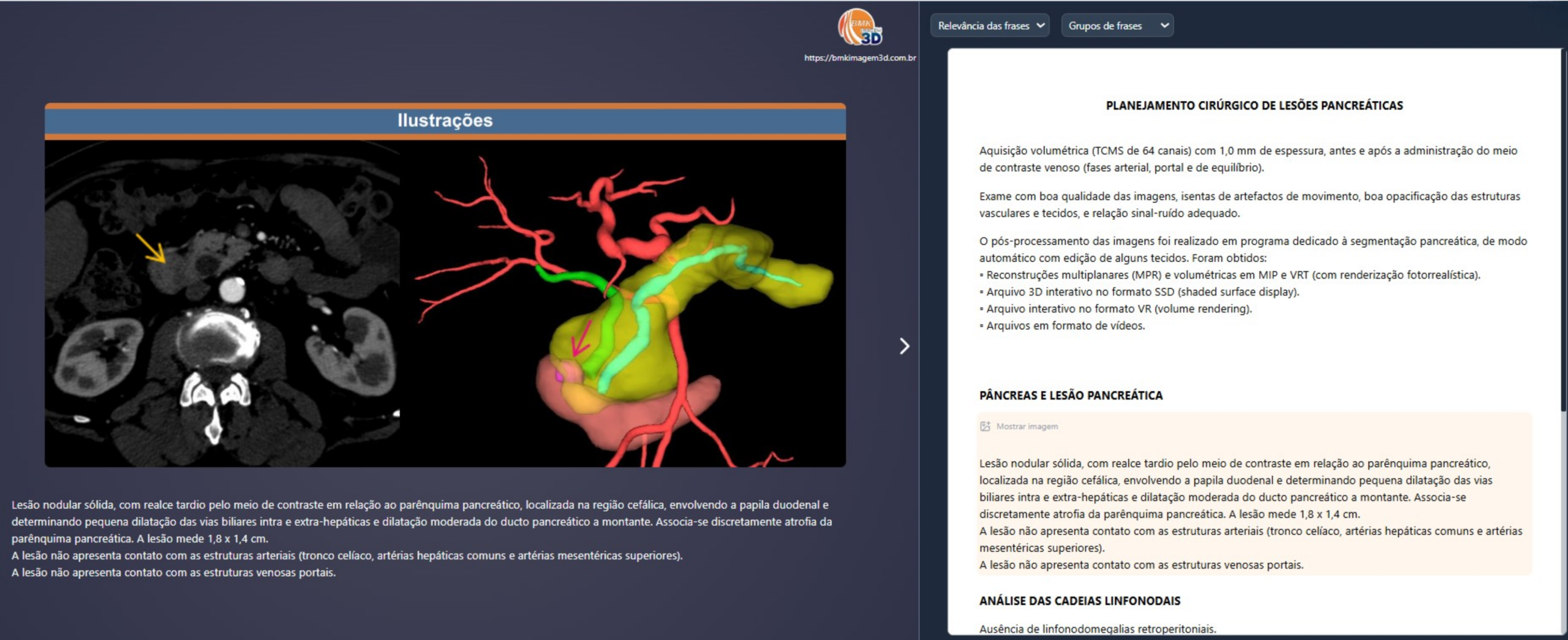 Laudo Interativo - Lesões Pancreáticas