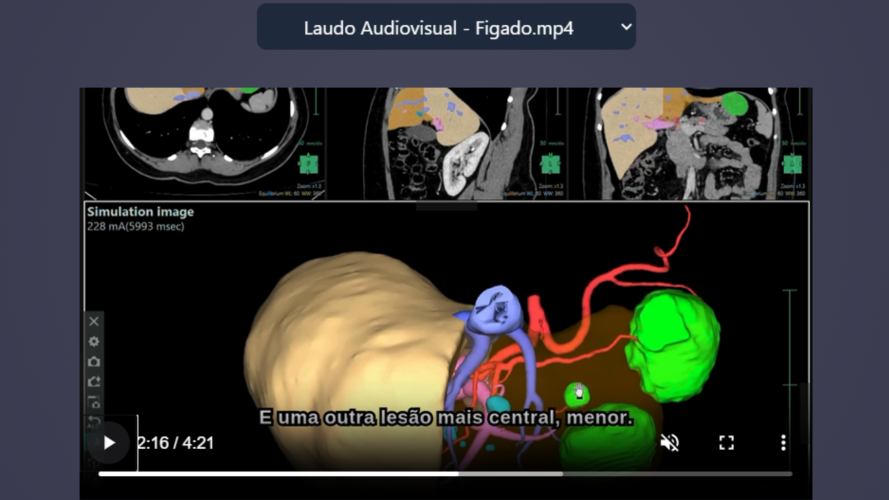 Laudo Audiovisual - Figado