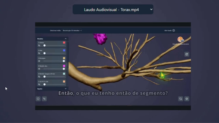 Laudo Audiovisual - Tórax